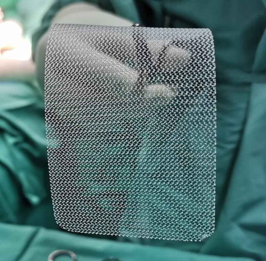Hernia Surgery Mesh