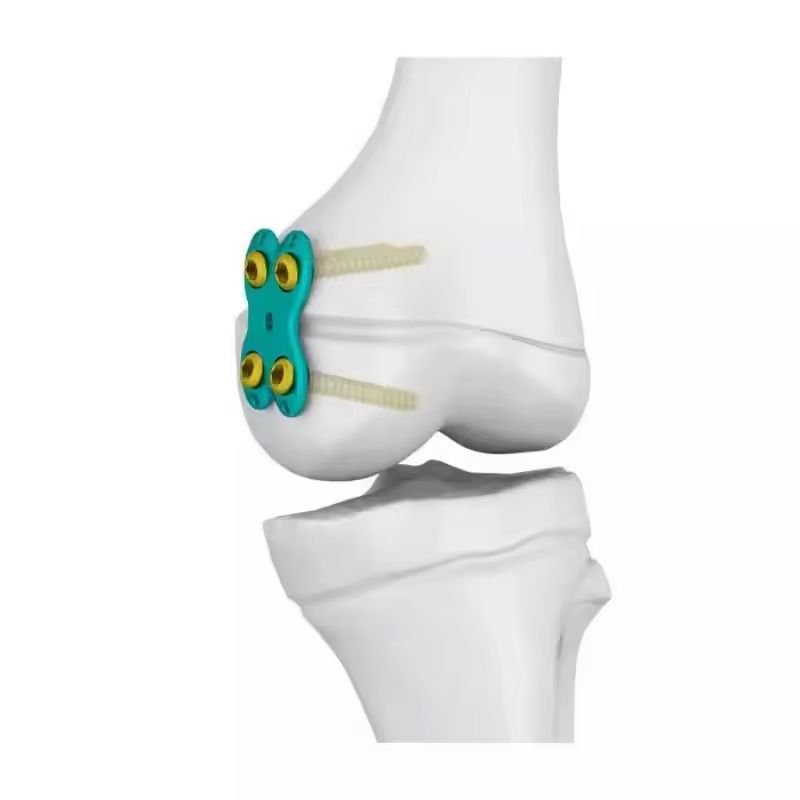 H-Shaped Stainless Steel Plate